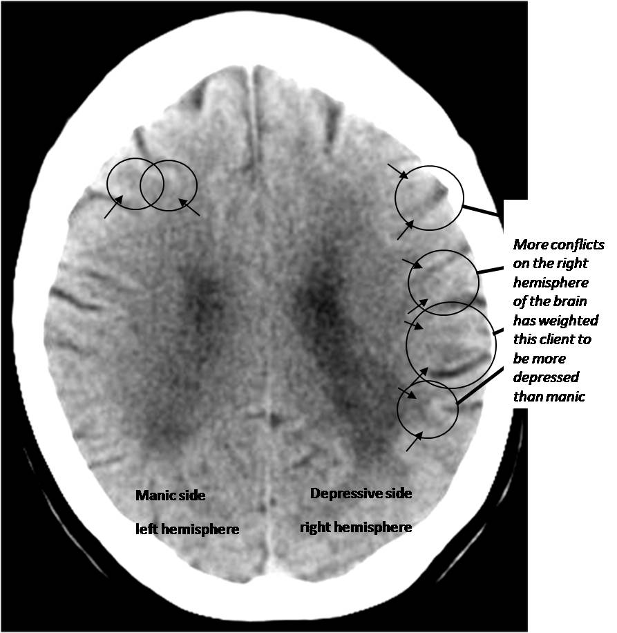 Book Samples Brain CT Examples Why am I Sick